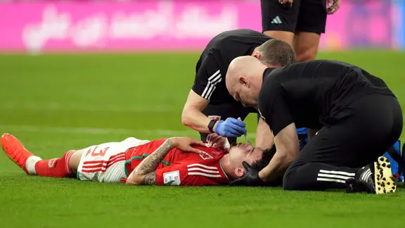 Concussion World Cup